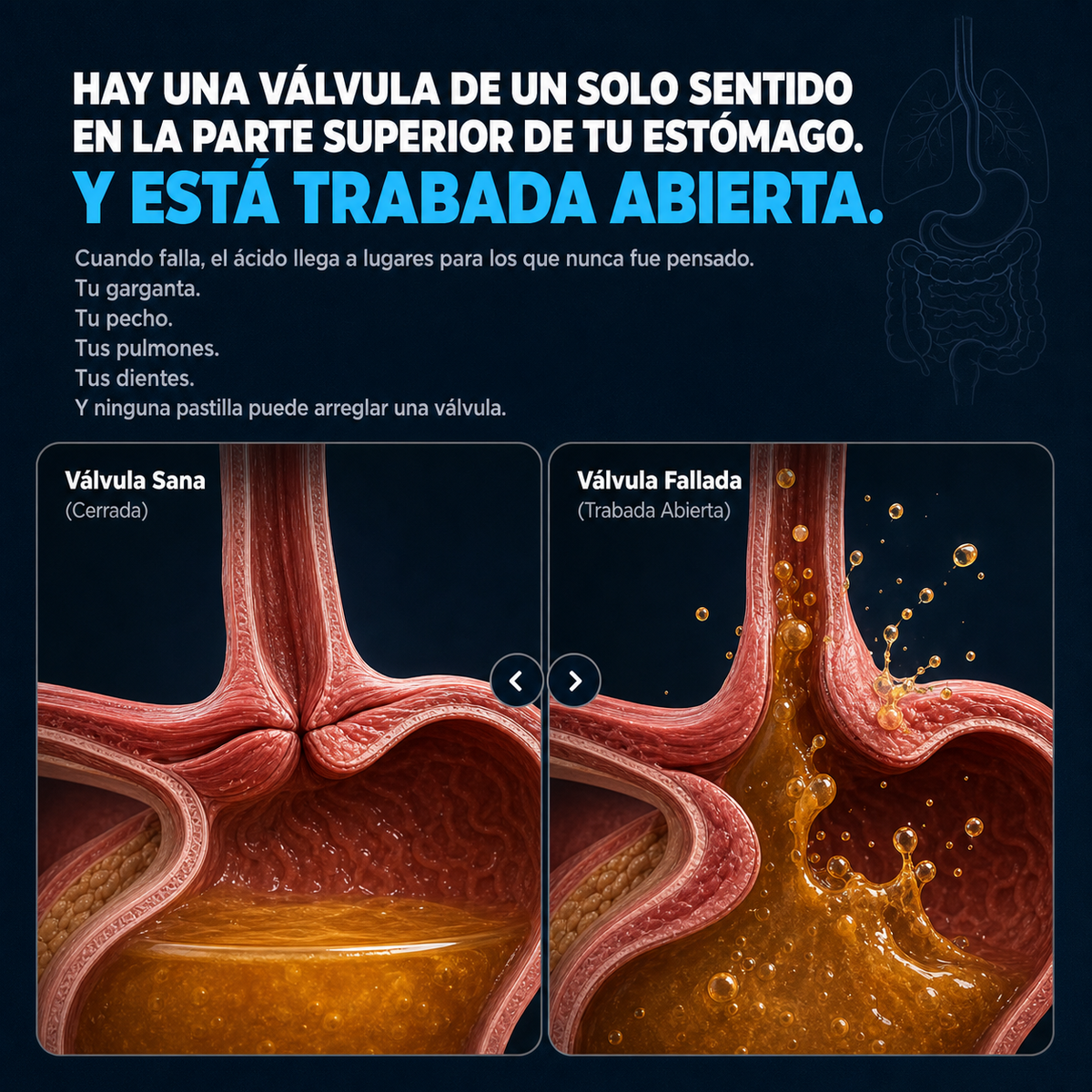 Reflux para la acidez estomacal